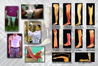 النيل للاطراف الصناعية